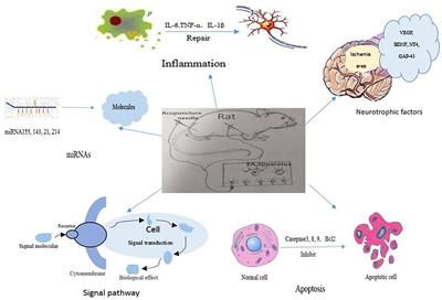 Mechanisms Involved in the Neuroprotection of Electroacupuncture Therapy for Ischemic Stroke